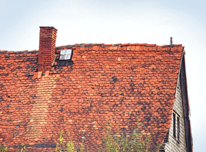 Shingles